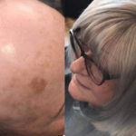 Hair Loss Integration Training 6