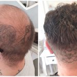 Hair Replacement System Male Toupee