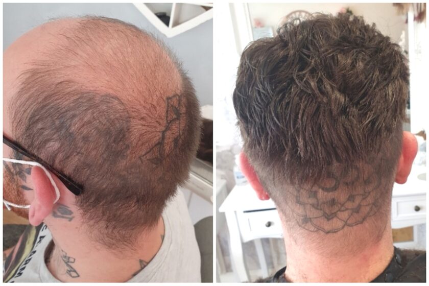 Hair Replacement System Male Toupee